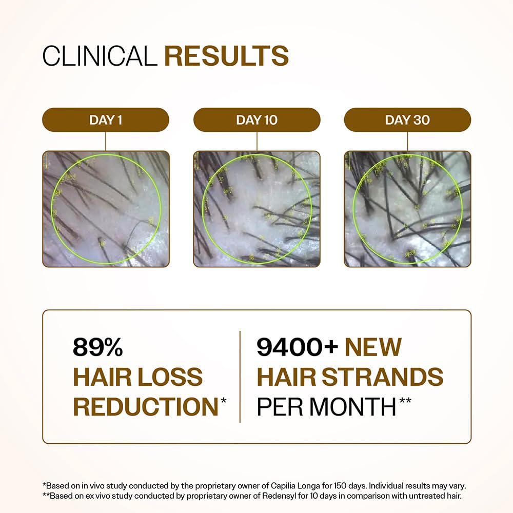 💆 Bare Anatomy Hair Density Serum – Reduces Hair Fall