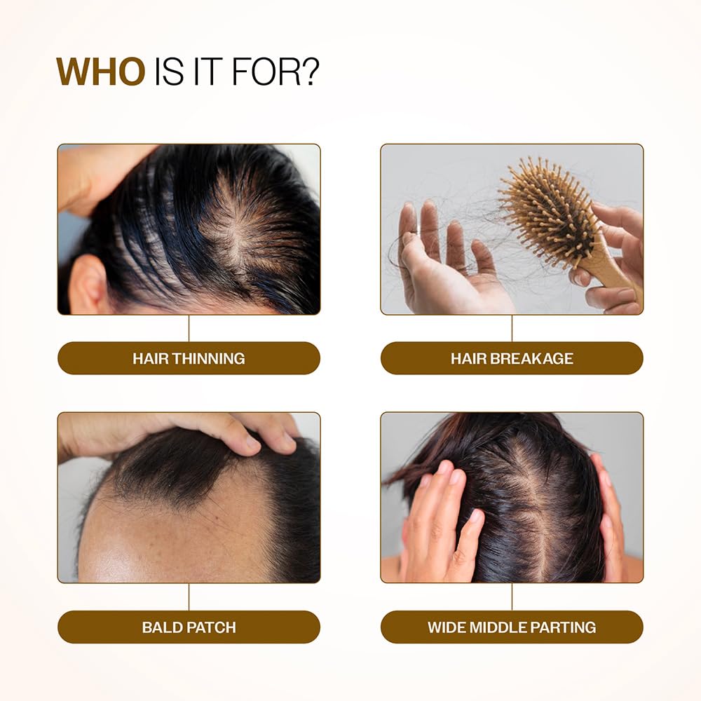 💆 Bare Anatomy Hair Density Serum – Reduces Hair Fall